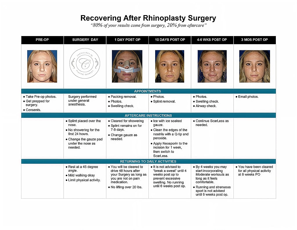 Rhinoplasty recovery timeline and aftercare instructions.