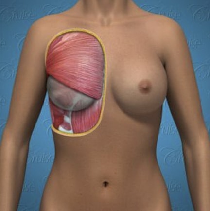 Anatomical illustration of breast and underlying structures.