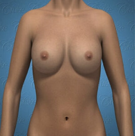 3D model of a female torso.