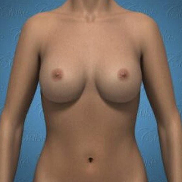 3D model of a female torso.