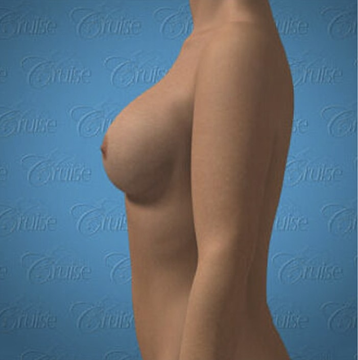 3D side view of a female torso.