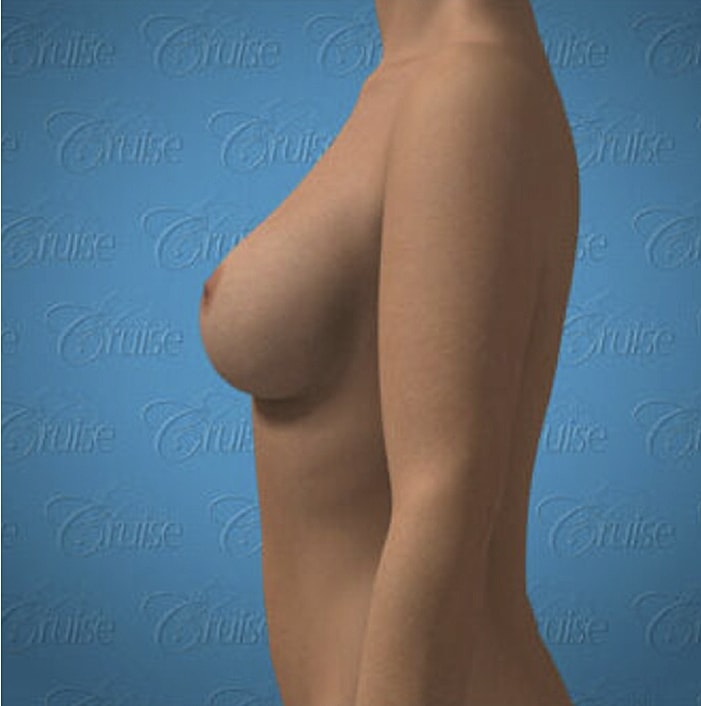 Side profile of a nude female figure.
