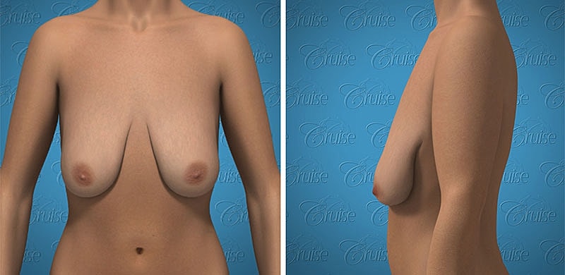 Realistic 3D model of human torso from various angles.