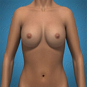3D model of a female torso.
