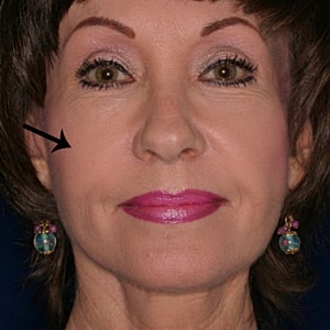 Woman with earrings and bold lipstick.