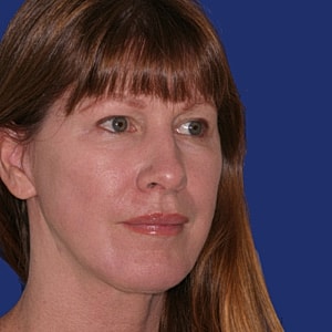 Profile of a woman against a blue background.
