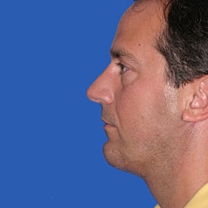 Profile view of a man against blue background.