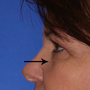 Profile view of a woman against blue background.