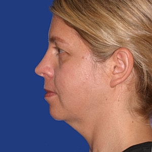 Profile view of a woman with light hair.