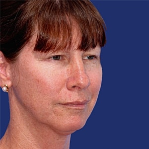 Profile view of a woman with light hair.