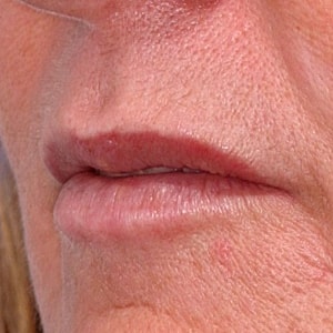 Close-up of lips and skin texture.
