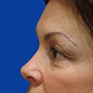 Profile view of woman with noticeable wrinkles.
