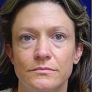 Profile view of woman with noticeable wrinkles.