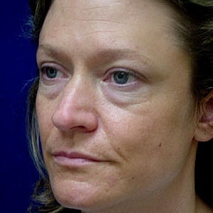 Profile view of woman with noticeable wrinkles.