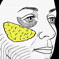 Profile view of woman with noticeable wrinkles.