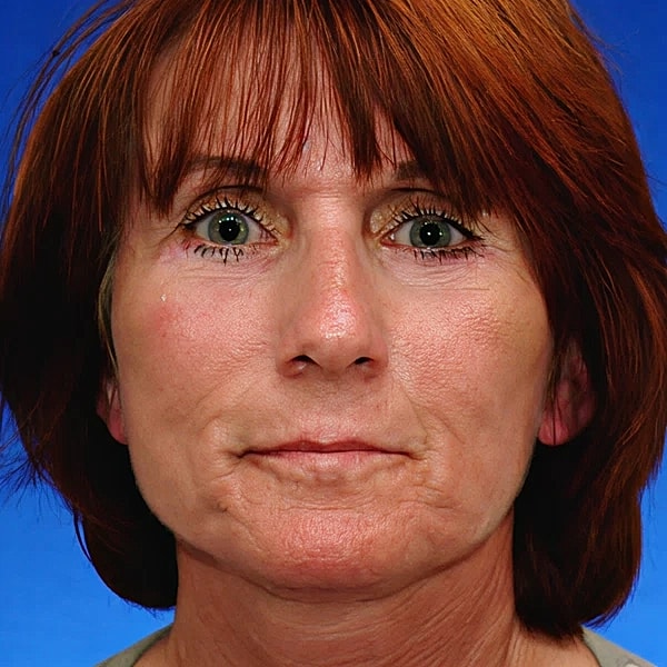 Woman's profile against blue background.