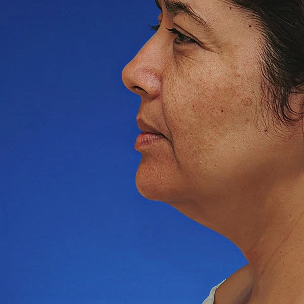 Profile of a woman against blue background.