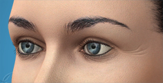 Animated upper eyelid surgery