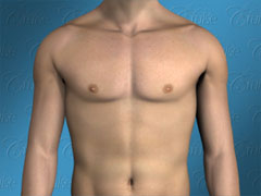 Animation of ideal male chest after gynecomastia surgery