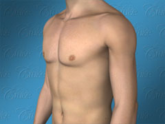 Animation of ideal male chest after gynecomastia surgery